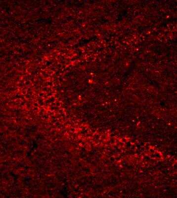 Immunohistochemistry-Frozen: p14ARF/CDKN2A Antibody [Biotin] [NB200-111B] - Mouse brain section, hippocampal (10 um thickness). 3% PFA perfused. 1:1000 dilultion. Image from verified customer review.